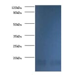 Nucleoside diphosphate kinase A Polyclonal Antibody from Signalway Antibody (42376) - Antibodies.com