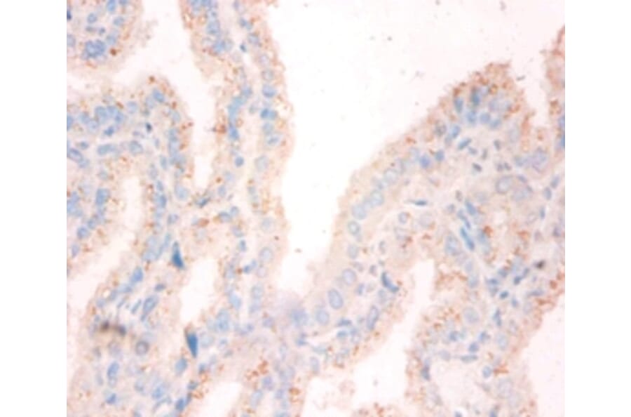 Immunohistochemistry - Nucleoside diphosphate kinase A Polyclonal Antibody from Signalway Antibody (42376)