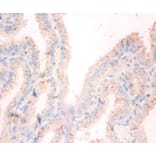 Immunohistochemistry - Nucleoside diphosphate kinase A Polyclonal Antibody from Signalway Antibody (42376)