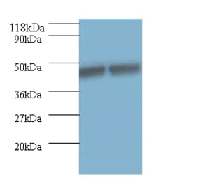 Keratin, type I cytoskeletal 18 Polyclonal Antibody from Signalway Antibody (42526) - Antibodies.com
