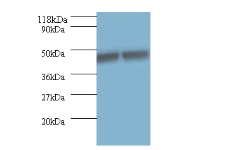 Keratin, type I cytoskeletal 18 Polyclonal Antibody from Signalway Antibody (42526) - Antibodies.com