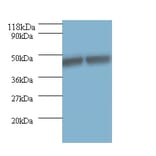 Keratin, type I cytoskeletal 18 Polyclonal Antibody from Signalway Antibody (42526) - Antibodies.com