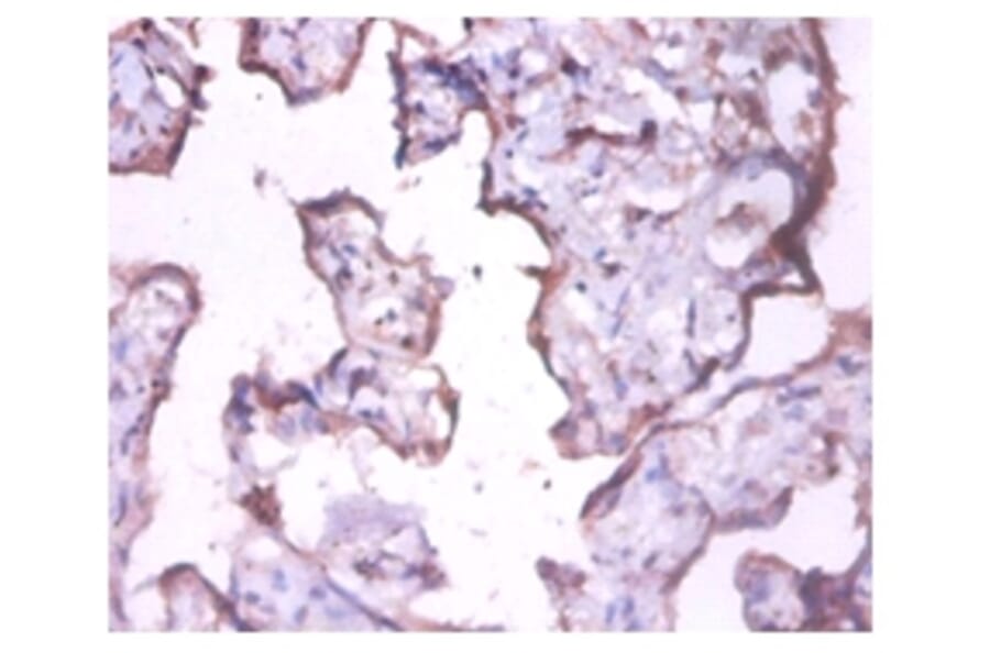 Immunohistochemistry - Keratin, type I cytoskeletal 18 Polyclonal Antibody from Signalway Antibody (42526)