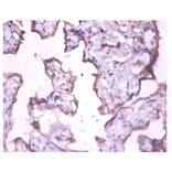 Immunohistochemistry - Keratin, type I cytoskeletal 18 Polyclonal Antibody from Signalway Antibody (42526)