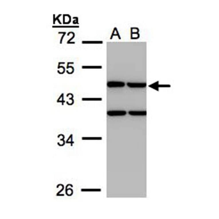 Creatine kinase (mitochondrial 1B) antibody from Signalway Antibody (22984) - Antibodies.com