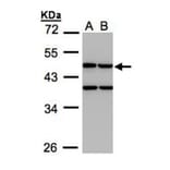 Creatine kinase (mitochondrial 1B) antibody from Signalway Antibody (22984) - Antibodies.com