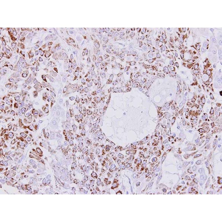 Immunohistochemistry - Creatine kinase (mitochondrial 1B) antibody from Signalway Antibody (22984) - Antibodies.com