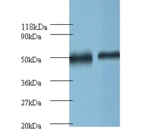 Ornithine decarboxylase Polyclonal Antibody from Signalway Antibody (42121) - Antibodies.com