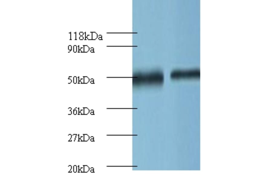 Ornithine decarboxylase Polyclonal Antibody from Signalway Antibody (42121) - Antibodies.com