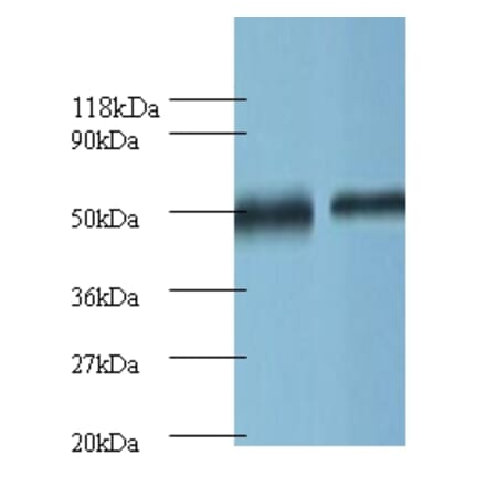 Ornithine decarboxylase Polyclonal Antibody from Signalway Antibody (42121) - Antibodies.com