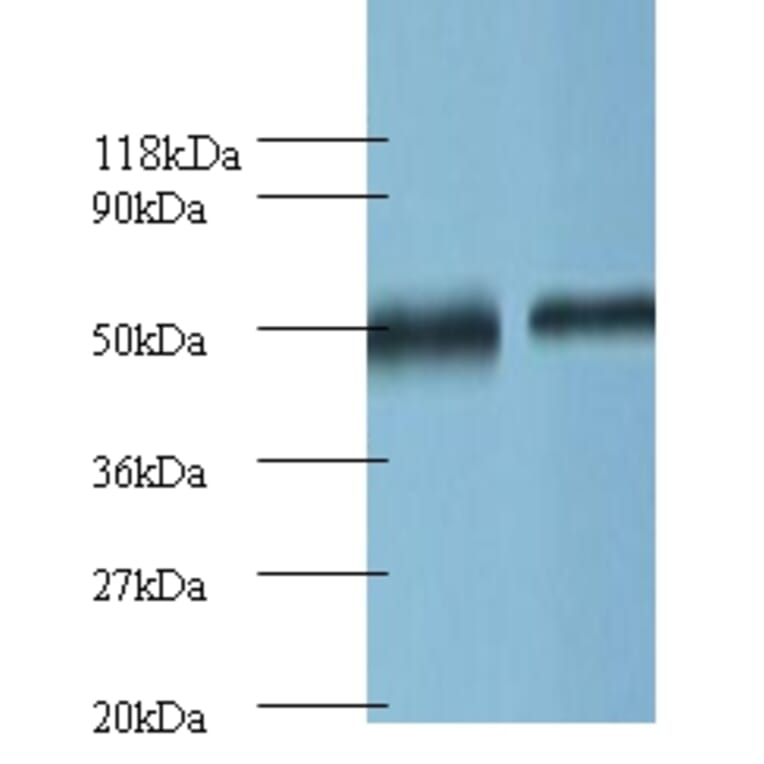 Ornithine decarboxylase Polyclonal Antibody from Signalway Antibody (42121) - Antibodies.com