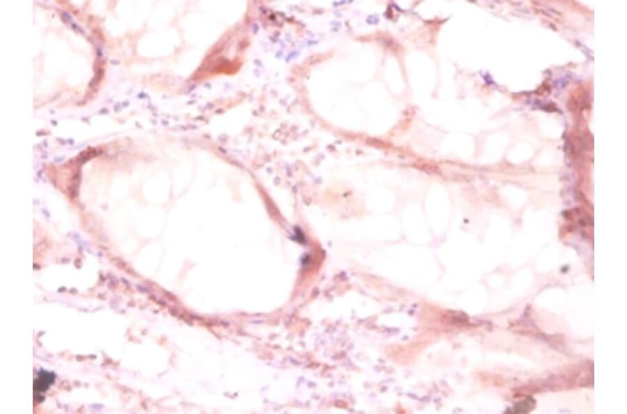 Immunohistochemistry - Ornithine decarboxylase Polyclonal Antibody from Signalway Antibody (42121) - Antibodies.com