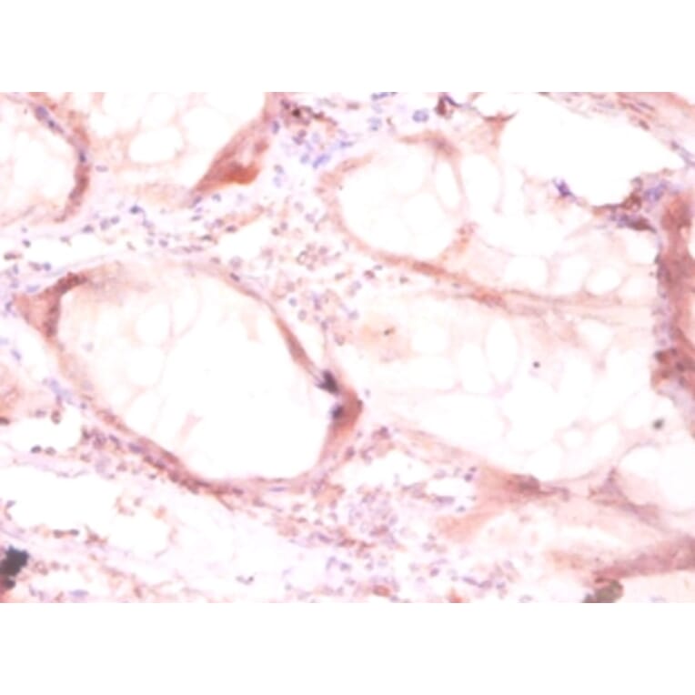 Immunohistochemistry - Ornithine decarboxylase Polyclonal Antibody from Signalway Antibody (42121) - Antibodies.com