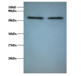 RNA-binding protein FUS Polyclonal Antibody from Signalway Antibody (42370) - Antibodies.com