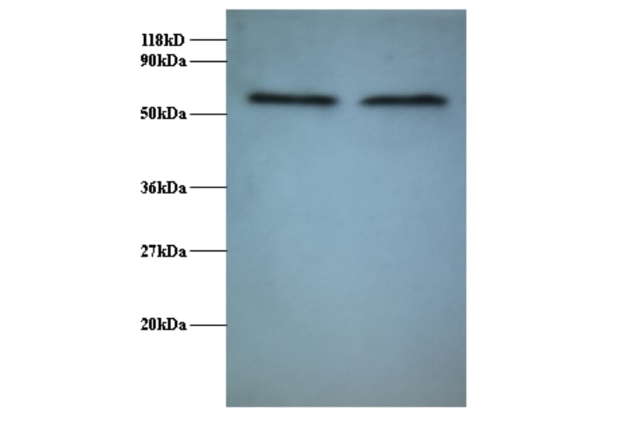 RNA-binding protein FUS Polyclonal Antibody from Signalway Antibody (42370) - Antibodies.com