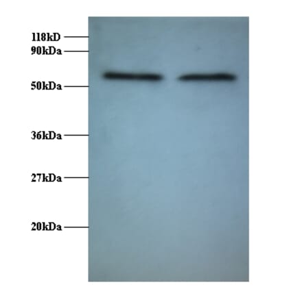 RNA-binding protein FUS Polyclonal Antibody from Signalway Antibody (42370) - Antibodies.com