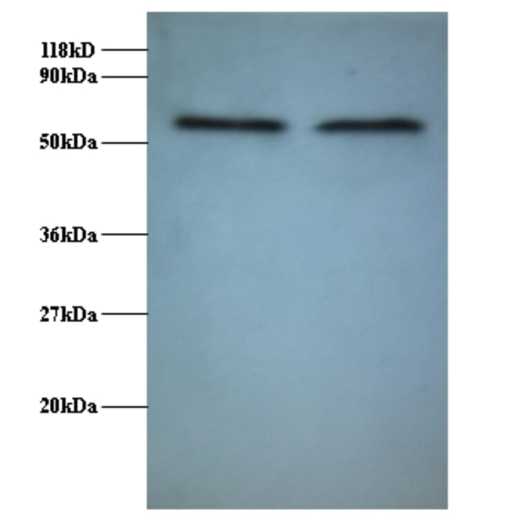 RNA-binding protein FUS Polyclonal Antibody from Signalway Antibody (42370) - Antibodies.com