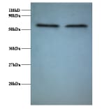 RNA-binding protein FUS Polyclonal Antibody from Signalway Antibody (42370) - Antibodies.com