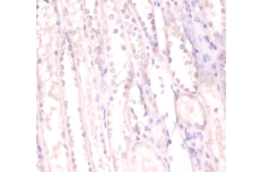 Immunohistochemistry - RNA-binding protein FUS Polyclonal Antibody from Signalway Antibody (42370) - Antibodies.com