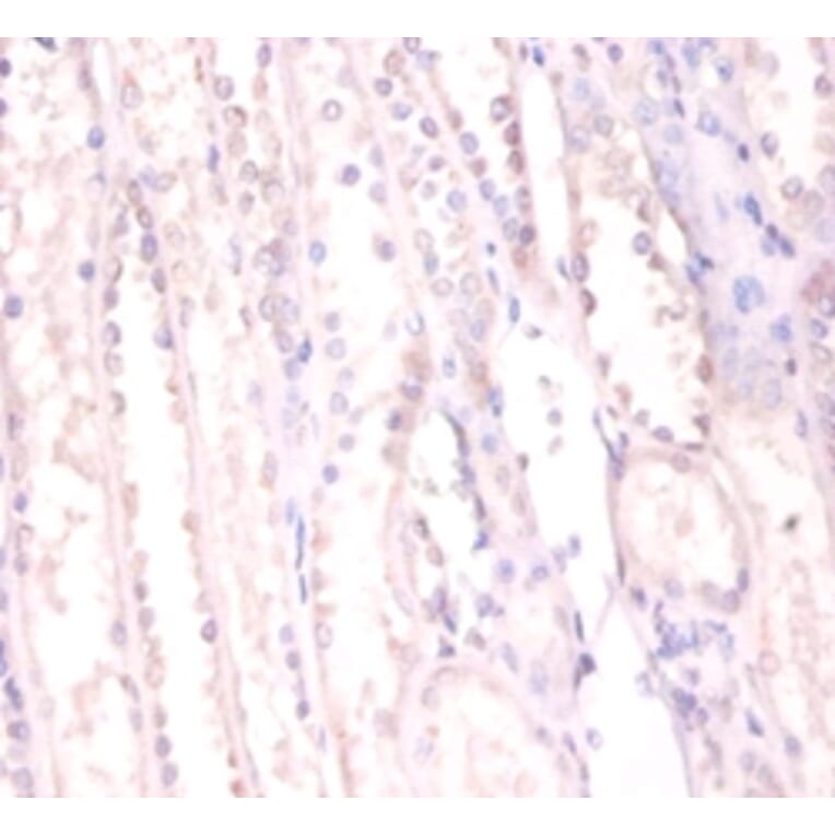 Immunohistochemistry - RNA-binding protein FUS Polyclonal Antibody from Signalway Antibody (42370) - Antibodies.com