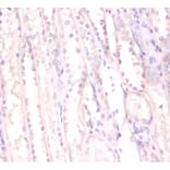 Immunohistochemistry - RNA-binding protein FUS Polyclonal Antibody from Signalway Antibody (42370) - Antibodies.com