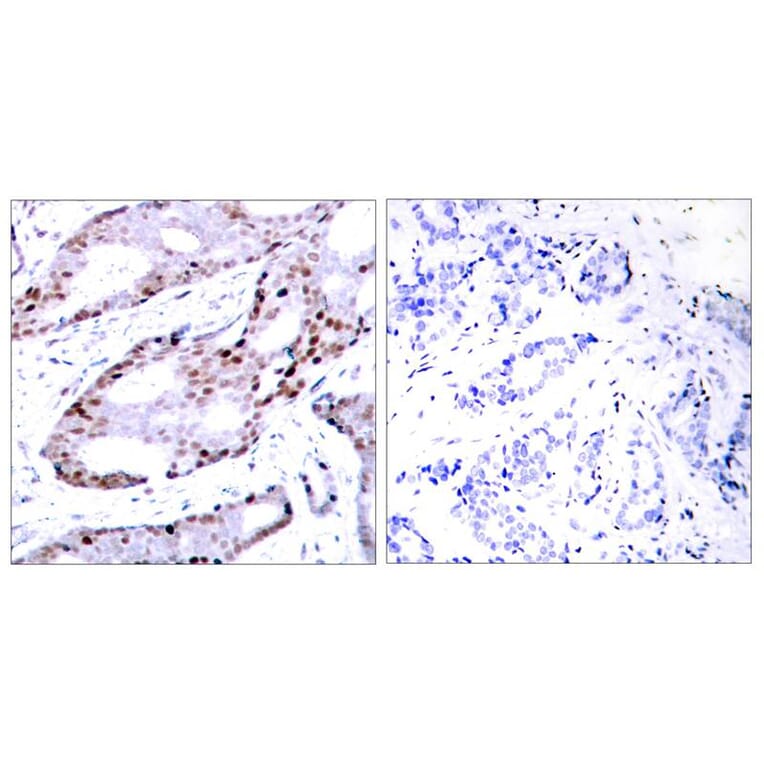 Immunohistochemistry - c-Jun (Ab-73) Antibody from Signalway Antibody (21003) - Antibodies.com