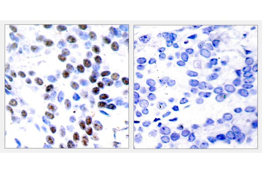 Immunohistochemistry - c-Jun (Ab-93) Antibody from Signalway Antibody (21022) - Antibodies.com