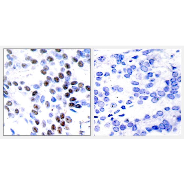 Immunohistochemistry - c-Jun (Ab-93) Antibody from Signalway Antibody (21022) - Antibodies.com