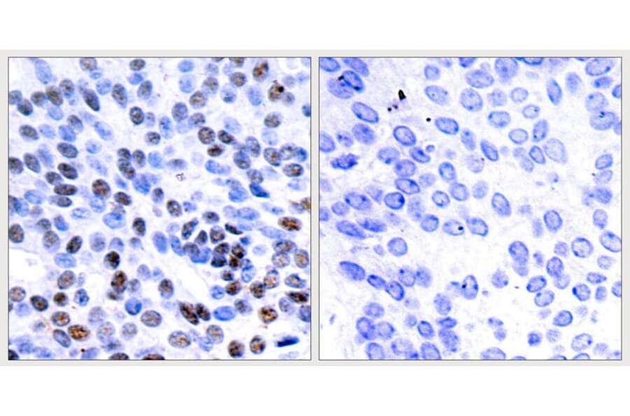 Immunohistochemistry - JunB (Ab-259) Antibody from Signalway Antibody (21027) - Antibodies.com