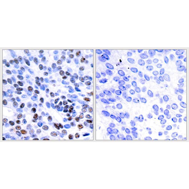 Immunohistochemistry - JunB (Ab-259) Antibody from Signalway Antibody (21027) - Antibodies.com