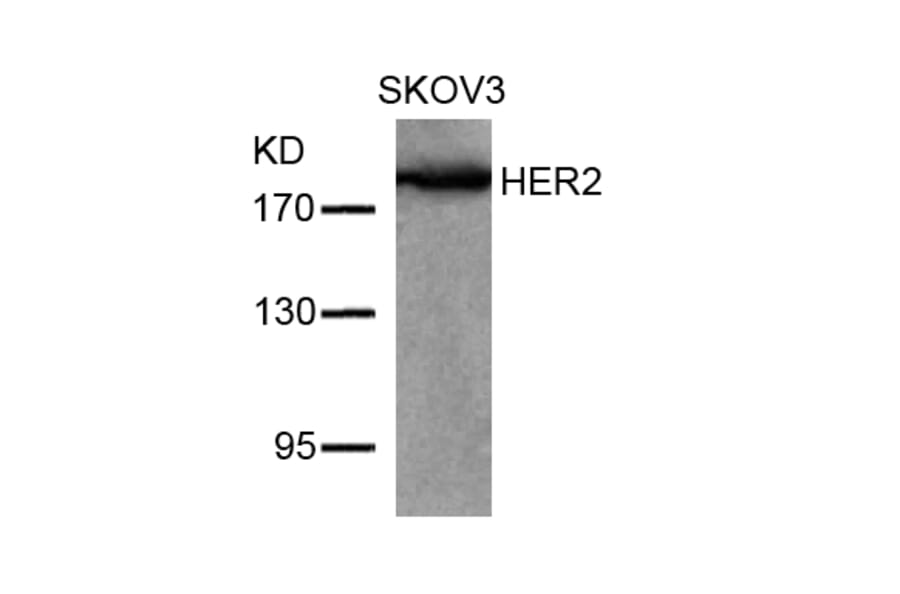 Western blot - HER2 (Ab-877) Antibody from Signalway Antibody (21070) - Antibodies.com