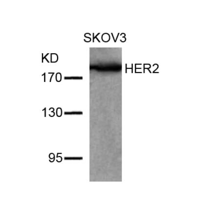 Western blot - HER2 (Ab-877) Antibody from Signalway Antibody (21070) - Antibodies.com