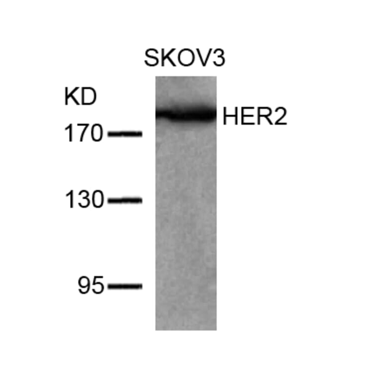 Western blot - HER2 (Ab-877) Antibody from Signalway Antibody (21070) - Antibodies.com