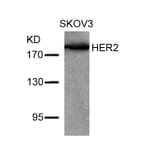 Western blot - HER2 (Ab-877) Antibody from Signalway Antibody (21070) - Antibodies.com