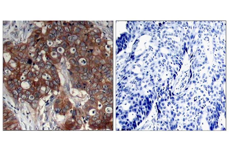 Immunohistochemistry - HER2 (Ab-877) Antibody from Signalway Antibody (21070) - Antibodies.com