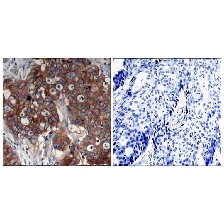 Immunohistochemistry - HER2 (Ab-877) Antibody from Signalway Antibody (21070) - Antibodies.com
