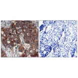 Immunohistochemistry - HER2 (Ab-877) Antibody from Signalway Antibody (21070) - Antibodies.com