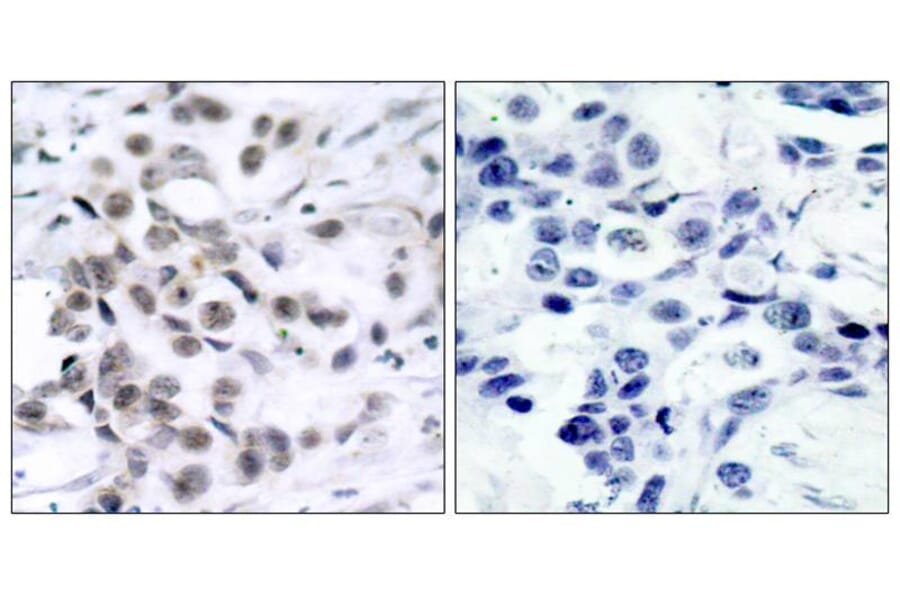 Immunohistochemistry - Chk1 (Ab-317) Antibody from Signalway Antibody (21114) - Antibodies.com