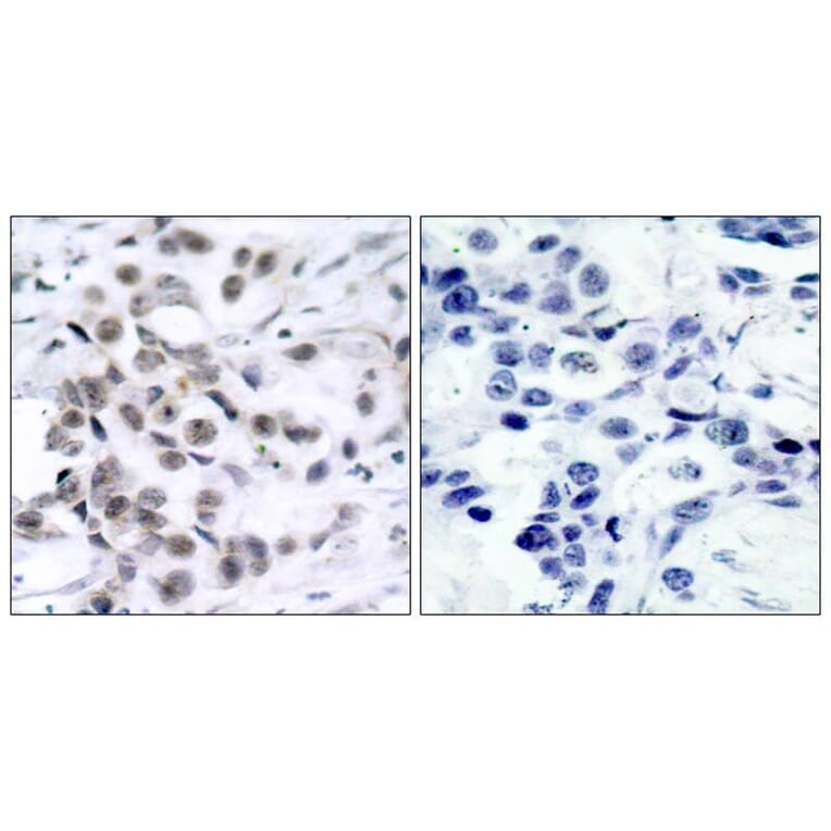 Immunohistochemistry - Chk1 (Ab-317) Antibody from Signalway Antibody (21114) - Antibodies.com