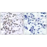 Immunohistochemistry - Chk1 (Ab-317) Antibody from Signalway Antibody (21114) - Antibodies.com