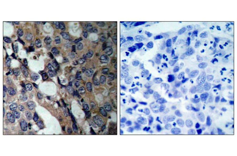 Immunohistochemistry - HSP27 (Ab-15) Antibody from Signalway Antibody (21144) - Antibodies.com