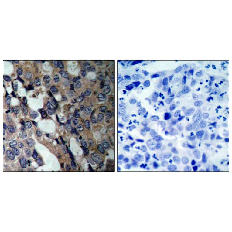 Immunohistochemistry - HSP27 (Ab-15) Antibody from Signalway Antibody (21144) - Antibodies.com