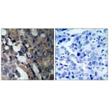 Immunohistochemistry - HSP27 (Ab-15) Antibody from Signalway Antibody (21144) - Antibodies.com