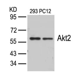 Western blot - Akt2 (Ab-474) Antibody from Signalway Antibody (21155) - Antibodies.com