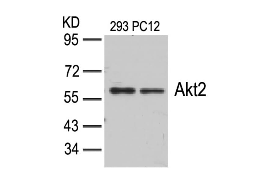 Western blot - Akt2 (Ab-474) Antibody from Signalway Antibody (21155) - Antibodies.com