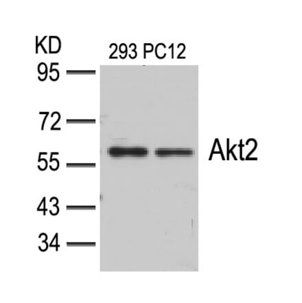 Western blot - Akt2 (Ab-474) Antibody from Signalway Antibody (21155) - Antibodies.com