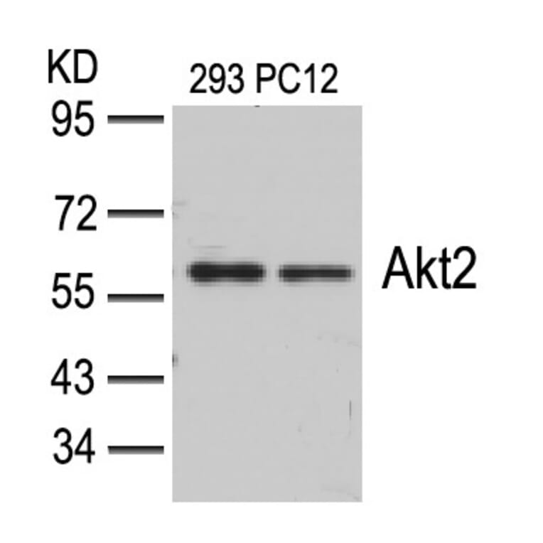 Western blot - Akt2 (Ab-474) Antibody from Signalway Antibody (21155) - Antibodies.com