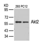 Western blot - Akt2 (Ab-474) Antibody from Signalway Antibody (21155) - Antibodies.com