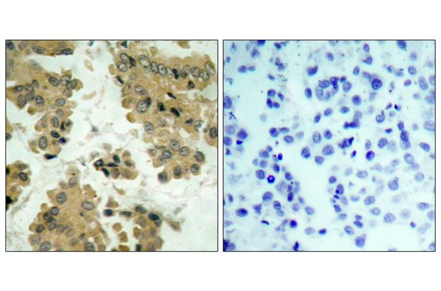 Immunohistochemistry - Akt2 (Ab-474) Antibody from Signalway Antibody (21155) - Antibodies.com