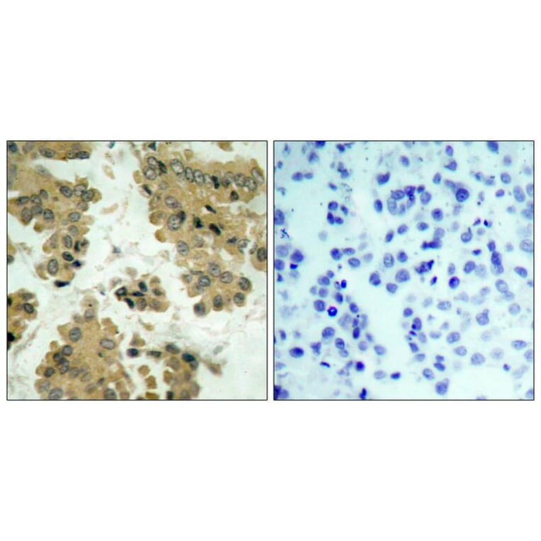 Immunohistochemistry - Akt2 (Ab-474) Antibody from Signalway Antibody (21155) - Antibodies.com